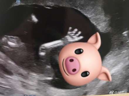 胡杏儿微博发文宣布怀上二胎：猪宝宝终于加入