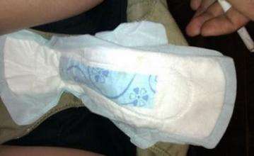 用错卫生巾对女生会有多大的危害
