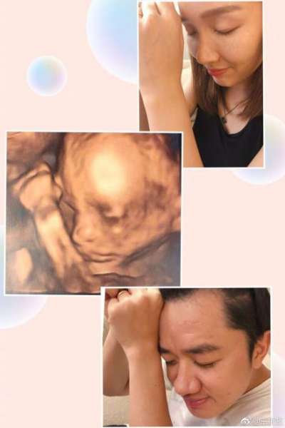 李亚男34岁生日 王祖蓝晒女儿超声波照片为老婆庆祝